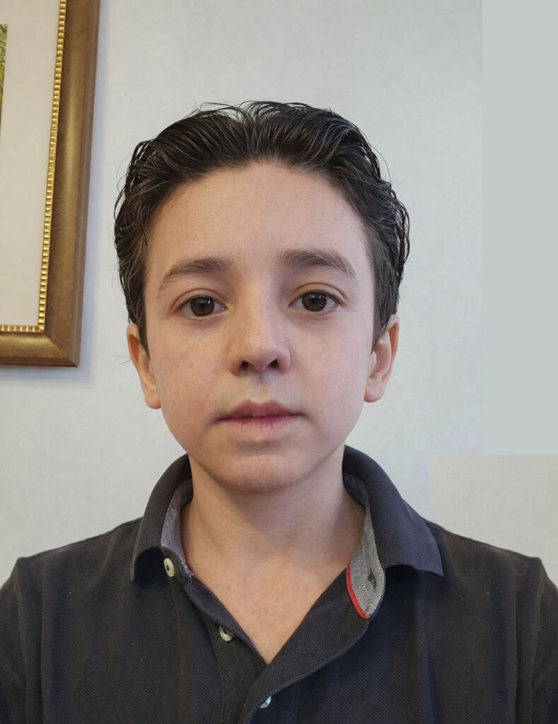 - "Vamos visitar o bebê da vizinha; mas ele nasceu sem orelhas, e eu não quero gracinhas; ouviu?"
Chegando lá, o Joãozinho põe a mão na cabeça do bebê diz:
- "Deus te dê boa visão, meu filho."
A mãe fica surpreendida, acha linda a sua preocupação e pergunta:
- "Por que você diz isso, filho?"
Responde o Joãozinho:
- "Porque, se precisar usar óculos, ele tá fudido!"